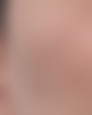 치료 후 사진 (로그인 후 열람)