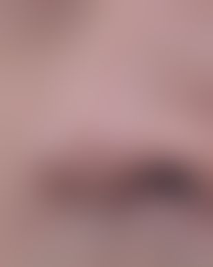 치료 후 사진 (로그인 후 열람)