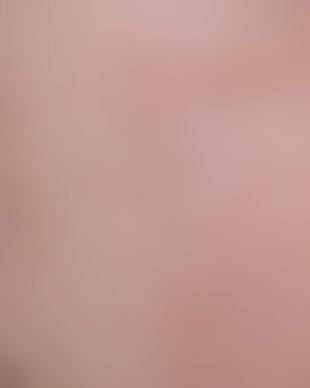 치료 후 사진 (로그인 후 열람)